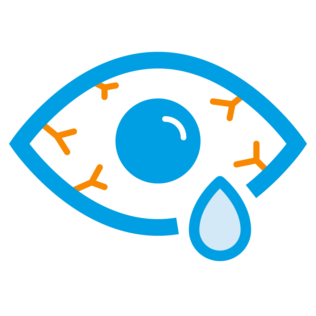 Lentilles et sécheresse oculaire